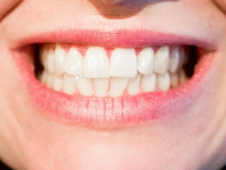 Implant dentaire Lyon : croyez-vous que ce soit une bonne idée ?